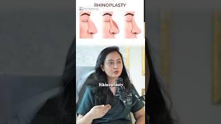 Can snoring be cured | Rhinoplasty for snoring #rhinoplasty #snoring #shorts