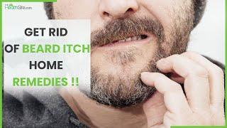 Men Beard: Know How To Get Rid Of Beard Itch || Home Remedies ||