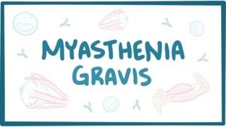 Myasthenia gravis - causes, symptoms, treatment, pathology