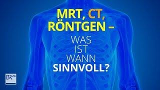 MRT, CT, Röntgen: Was ist wann sinnvoll und wie steht es um die Nebenwirkungen? | BR24