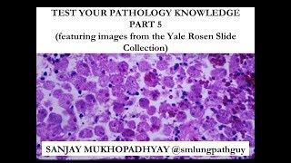 Test Your Pathology Knowledge, Part 5