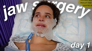 I HAD JAW SURGERY | day 1 vlog | hospital experience