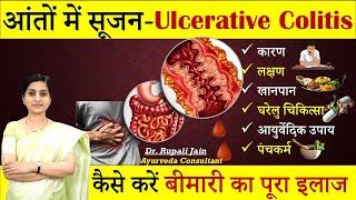 आँतों में सूजन- घाव (Ulcerative Colitis) ||अल्सरेटिव कोलाइटिस Ayurvedic Treatment & Diet Plan#health