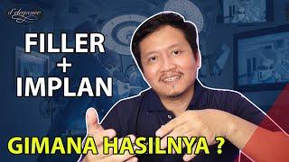 FILLER SETELAH IMPLAN, EMANG BOLEH ? // Podcast dokter hendri