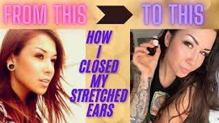 (ASMR) how I closed my stretched ears “gauges” at home. Cheap & easy. Step by step. Soft spoken