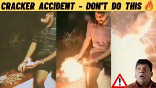 Funny Fire Accident | Diwali Crackers  | Fireworks | Diwali Incident | Cracker Funny Video | Tamil