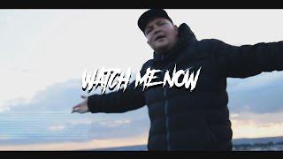 KEMPY - WATCH ME NOW (Official Video)