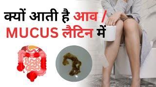 क्यों आता है आपके मल मे आव (म्यूकस) ! Mucus in stool | #drzubindevshrma #mucusinstool #mucus #stool