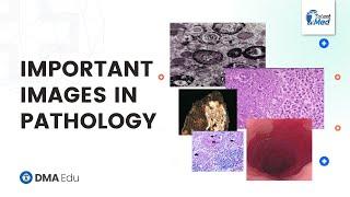 Important images in Pathology  in FMGE  | Pathology Most Expected Images in FMGE/NEET-PG | DMA