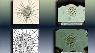 actinosphaerium   multinucleated; WEV