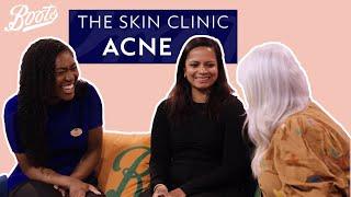 Everything you NEED to know about ACNE  | The Skin Clinic with Jo Hoare | Boots UK