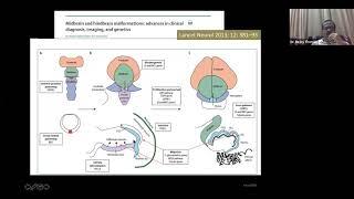 Brainstem and beyond