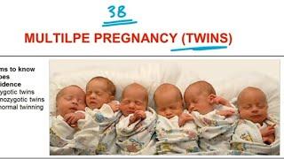 Multiple pregnancy (TWINS) | L57|  شرح بالعربي ـ طب بشري اسيوط