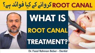 Root Canal Treatment Kya Hai? | What are Benefits of Root Canal Treatment in Pashto