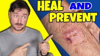 This Solves Skin Tears & Thin Skin Issues | Chris Gibson