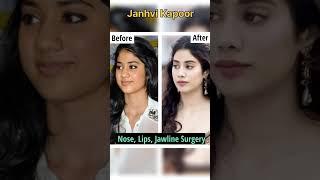 Shocking Plastic Surgery Look of Bollywood Actress #shorts #bollywood #actress #topview