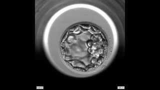 EmbryoScope Embryo Development - Blastocyst