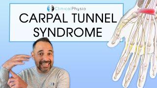 Carpal Tunnel Syndrome | Expert Physio Overview with Diagnosis Tips and Exercises!