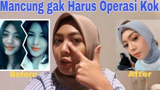 Tips Memancungkan Hidung Tanpa Operasi | VIRAL Cara Alami Hidung Mancung | NO CLICKBAIT