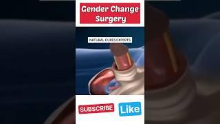 Male to female gender reassignment surgery! #shorts #male #female #shortsvideo #shortsvideo #viral