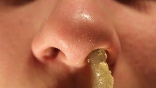 Huge Booger Removal