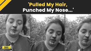 Woman On Scooter With 2 Kids, 'Punched' By A Man, Narrates Pune Road Rage Horror