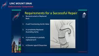 Type A Aortic Dissection: Identification and Treatment Options, Is it Still a Surgical Emergency?