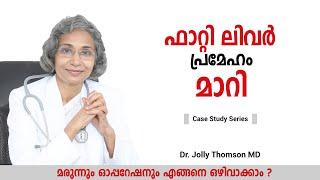 ഫാറ്റി ലിവർ പ്രമേഹം,മാറി [Case Study]- 47 yr old Fatty Liver, Diabetes,Reversed