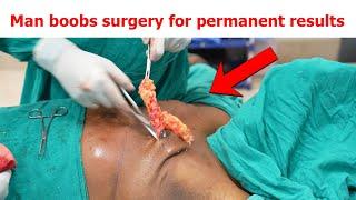 Gynecomastia Surgery cost