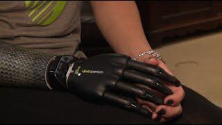 Bionic model, Down teen to strut on NY fashion runway