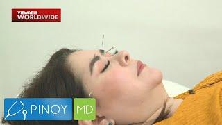 Connie Sison, sinubukan ang whole body acupuncture! | Pinoy MD