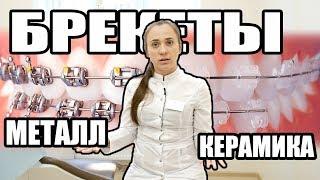 Сравнение БРЕКЕТОВ. Металл против Керамики