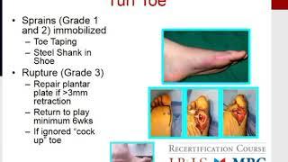 MILLER'S 2016 Orthopaedics:  Foot and Ankle