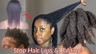 Do this ONCE a week and your hair will never stop growing | DIY for hair loss and balding