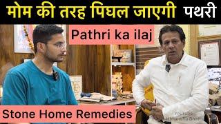 Stone Treatment at Home | Kidney Stone | Gallbladder Stone | Urinary Tract Stone | Pathri ka ilaj