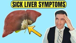 8 Warning Signs Of FATTY LIVER