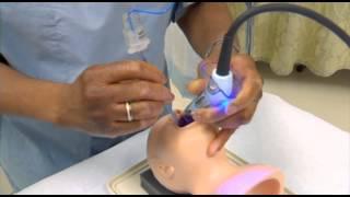 GlideScope Pediatric Airway Rounds Techniques: Advancing the ETT