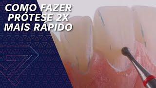 COMO FAZER PRÓTESE 2X MAIS RÁPIDO | Ginetom Rodrigues