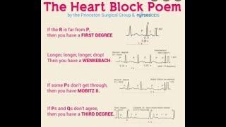 HEART BLOCK ECG INTERPRETATION