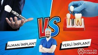 Hangi İmplantı Tercih Etmeliyiz Yerli mi ? İthalmi ? / Dr . Ali Onur Saydam