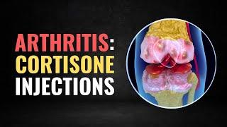 Do Cortisone Shots ACTUALLY Work for Knee Arthritis?