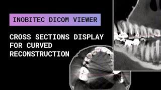 Cross sections display for curved reconstruction