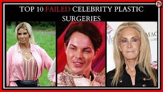 Top 10 Surgeries That Failed of Hollywood's Most Famous Faces |#clebritynews #awesomenewschannel