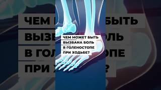 Боль в голеностопе: от чего? #больвголеностопе #болитголеностоп #голеностоп #болиголеностоп