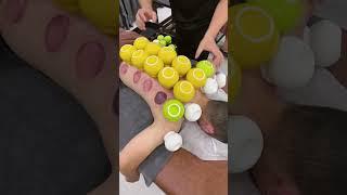 [ASMR] Cupping Therapy #cupping #asmr #LongKyASMR