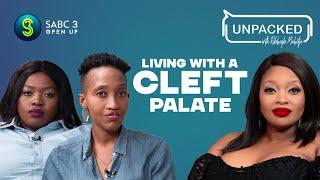 Living With A Cleft Palate | Unpacked with Relebogile Mabotja - Episode 116 | Season 3