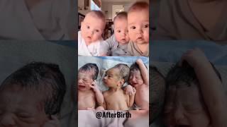 Let's see the Most Beautiful thing on Earth || Triplet Newborn Babies @AfterBirth