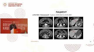 Разбор клинических наблюдений: рак тонкой кишки