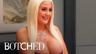 Foreign Hydrogel Butt Injections Cause Big Booty Problems | Botched | E!