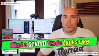 How I lost $905 on LITE: Trade Review: LITE & FB